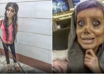 Viral,Gadis Iran yang Dipermak Jadi Angelina Jolie