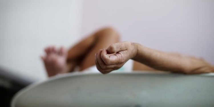 Lebih dari 80.000 Anak-anak Yaman Meninggal Akibat Perang