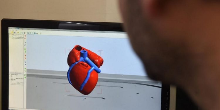 Ilmuwan Sukses Cetak Jantung 3D Pertama di dunia Gunakan Sel Pasien Sendiri