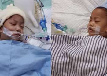 Aqila dan Azila tak Lagi Berbagi Dada