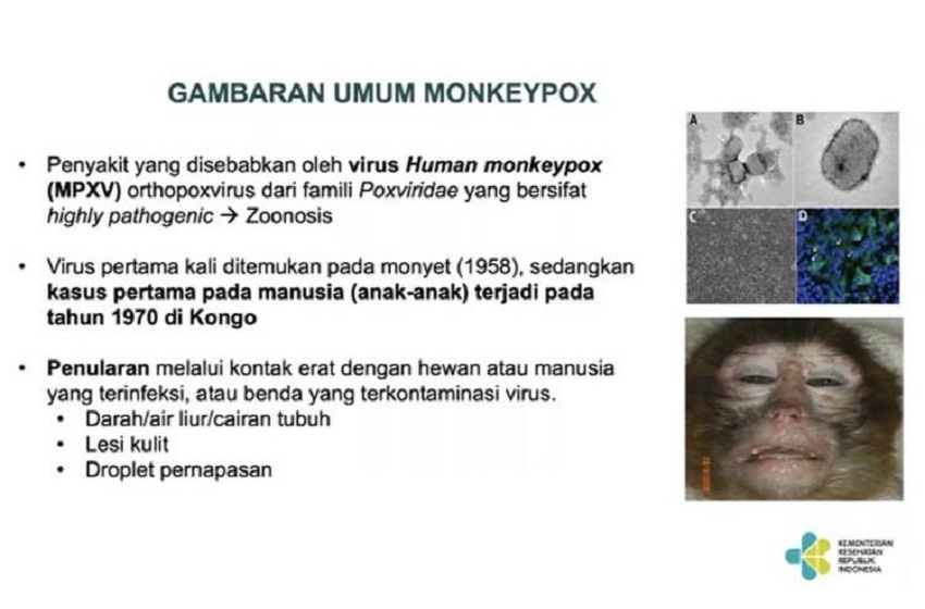  50 Strain Baru Monkeypox Ditemukan Dalam 3 Bulan Terakhir